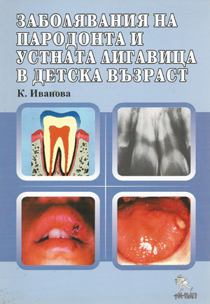 Заболявания на пародонта и устната лигавица в детска възраст