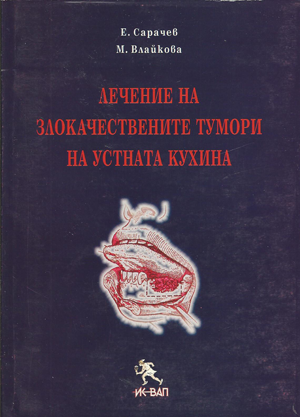 Лечение на злокачествените тумори на устната кухина