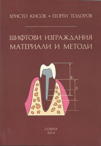 Щифтови изграждания, материали и методи