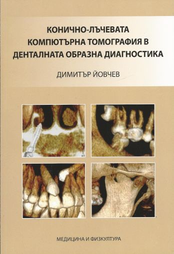 Конично-лъчевата компютърна томография в денталната образна диагностика