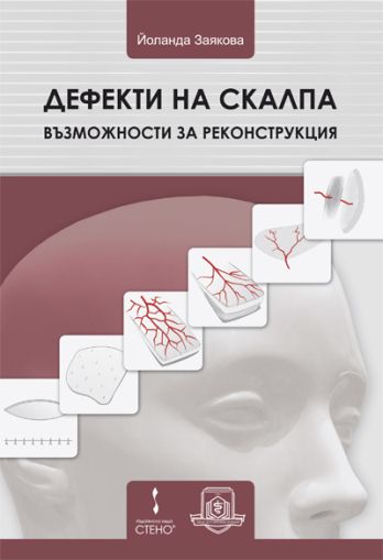 Дефекти на скалпа - възможности за реконструкция