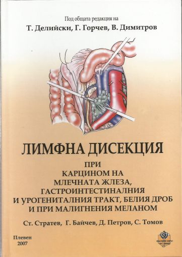 Лимфна дисекция при карцином на млечната жлеза, гастроинтестиналния и урогениталния тракт