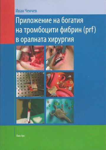 Приложение на богатия на тромбоцити фибрин (prf) в оралната хирургия