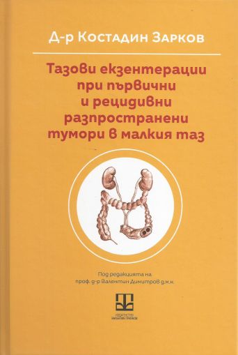 Тазови екзентерации при първични и рецидивни разпространени тумори в малкия таз