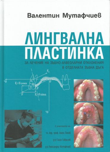 Лингвална пластинка за лечение на зъбно-алвеоларни отклонения в отделната зъбна дъга