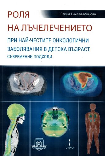 Роля на лъчелечението при най-честите онкологични заболявания в детска възраст - съвременни подходи