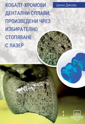 Кобалт-хромови дентални сплави, произведени чрез избирателно стопяване с лазер