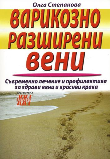 Варикозно разширени вени