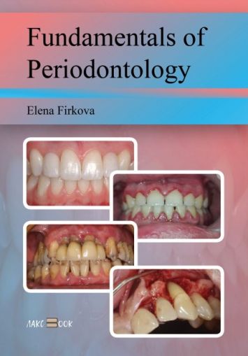 Fundamentals of Periodоntology