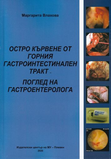 Остро кървене от горния гастроинтестинален тракт