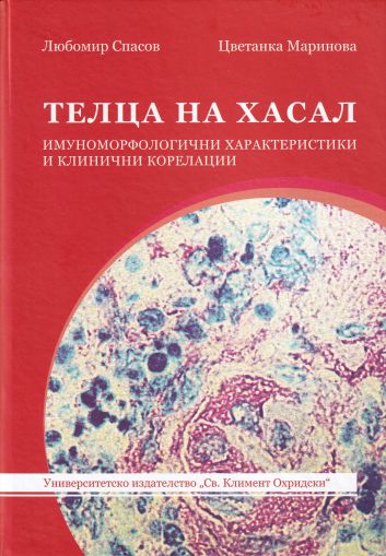 Телца на Хасал. Имуноморфологични характеристики и клинични корелации