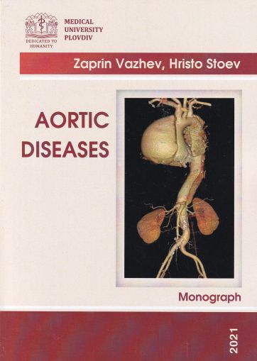 Aortic Diseases