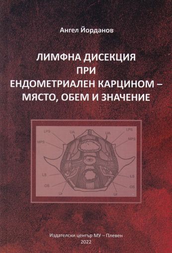 Лимфна дисекция при ендометриален карцином - място, обем и значение