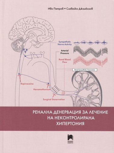 Ренална денервация за лечение на неконтролирана хипертония