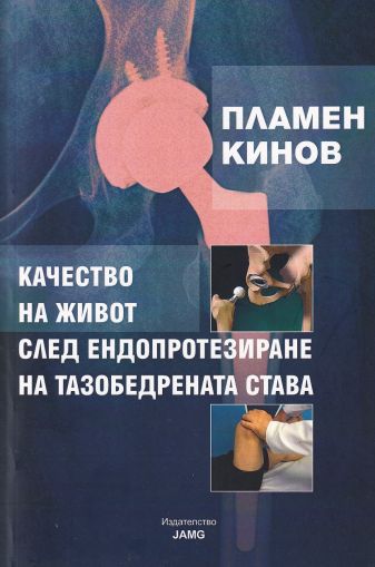 Качество на живот след ендопротезиране на тазобедрената става