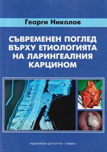 Съвременен поглед върху етиологията на ларингеалния карцином