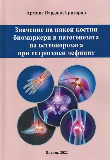 Значение на някои костни биомаркери в патогенезата на остеопорозата при естрогенен дефицит