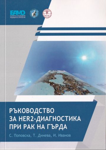 Ръководство за HER2 - диагностика при рак на гърдата