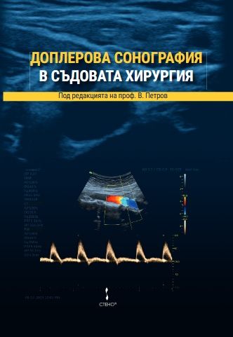 Доплерова сонография в съдовата хирургия