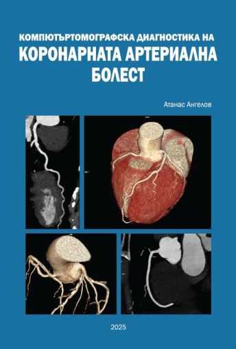 Компютъртомографска диагностика на коронарната артериална болест