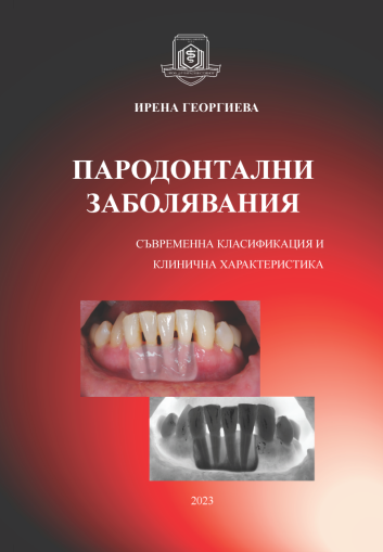 Пародонтални заболявания