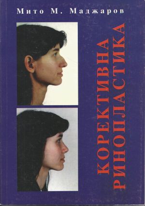 Корективна ринопластика