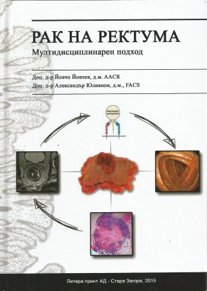 Рак на ректума. Мултидисциплинарен подход